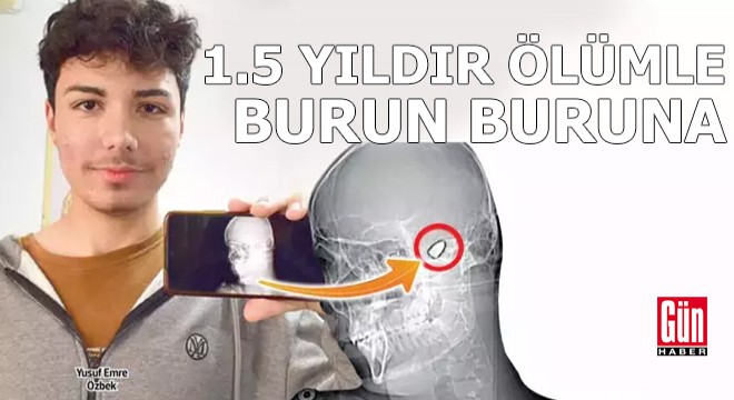 1.5 yıldır ölümle burun buruna