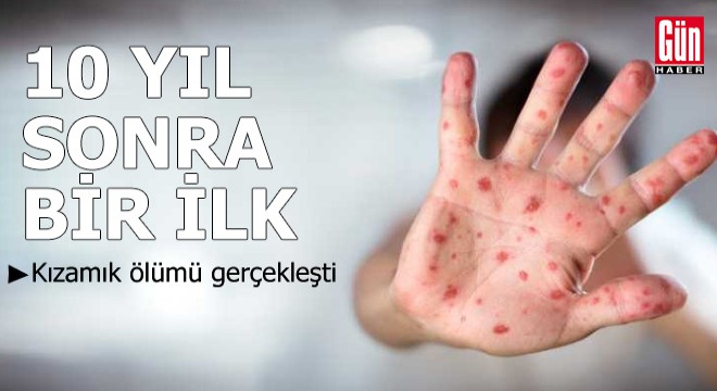10 yıl sonra bir ilk: Kızamık ölümü gerçekleşti