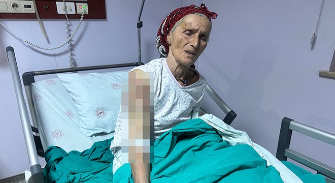65 yaşındaki kadına 7 köpek saldırdı