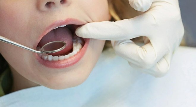 9 yaşındaki çocuk diş tedavisi sonrası hayatını kaybetti