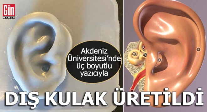 Akdeniz Üniversitesi Teknokent'te yapay dokuyla dış kulak yapıldı