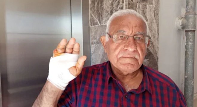 Akılalmaz olay: Komşusu parmağını ısırarak kopardı