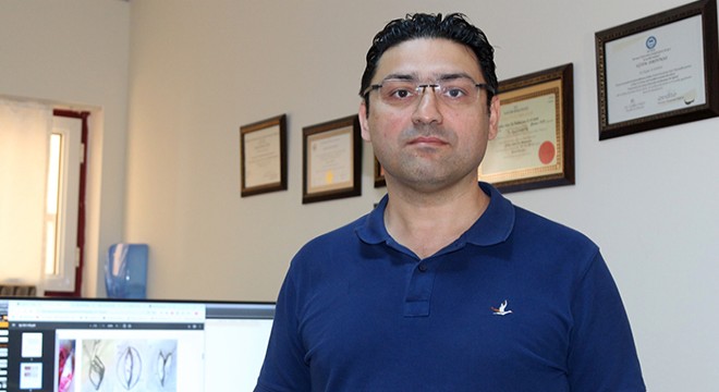 Antalya'da kıl dönmesine estetik ve kalıcı müdahale
