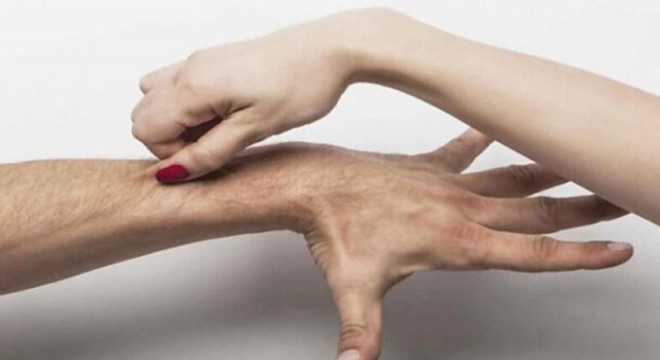 Çimdikleme, boşanma nedeni sayıldı