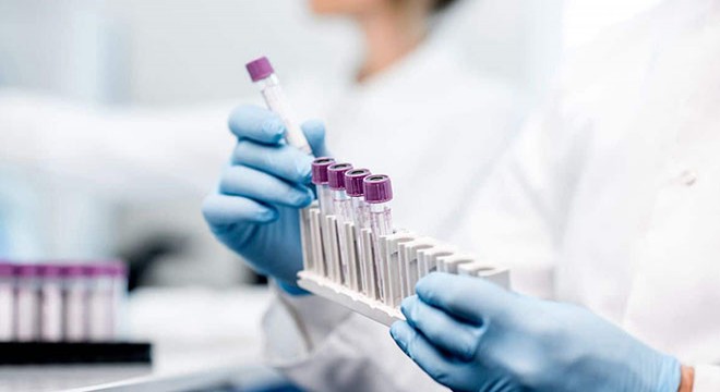 Cinsel yolla bulaşan enfeksiyonların moleküler testlerle teşhisi mümkün, kolay ve hızlı