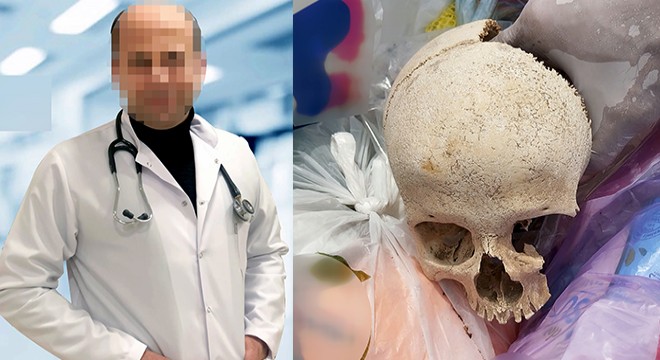 Çöpte bulunan kafatasını, uzman doktorun temizlik yapan eşi atmış