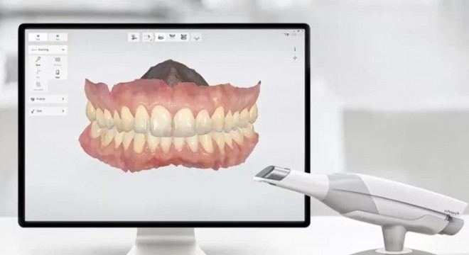 Dijital Gülüş Tasarımı Nedir?