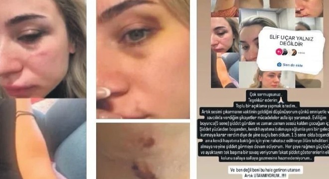 Elif öğretmenden yardım çığlığı