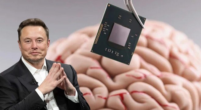 Elon Musk'ın Neuralink şirketi beyin çipi takmaya hazır