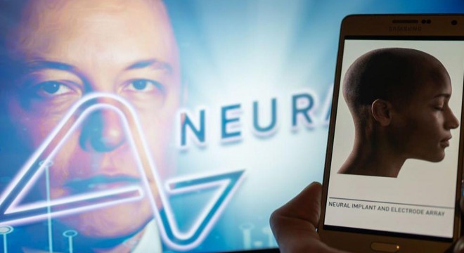 Elon Musk'ın şirketi bir insanın beynine çip yerleştirdi