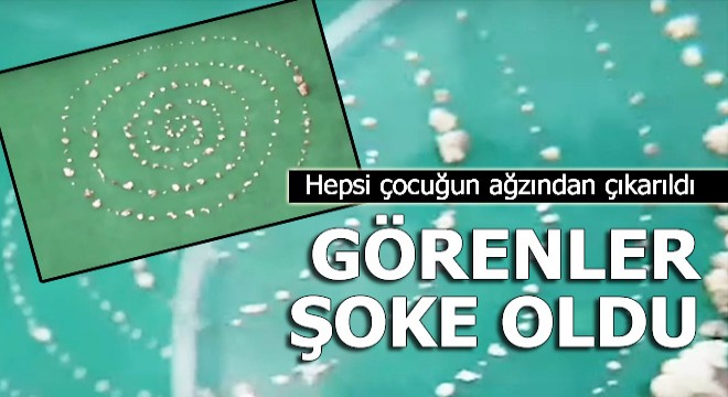 Görenler şoke oldu! Hepsi çocuğun ağzından çıkarıldı