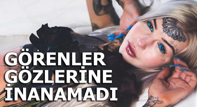 Gözlerine mürekkep enjekte ettirdi! Görenler inanamadı