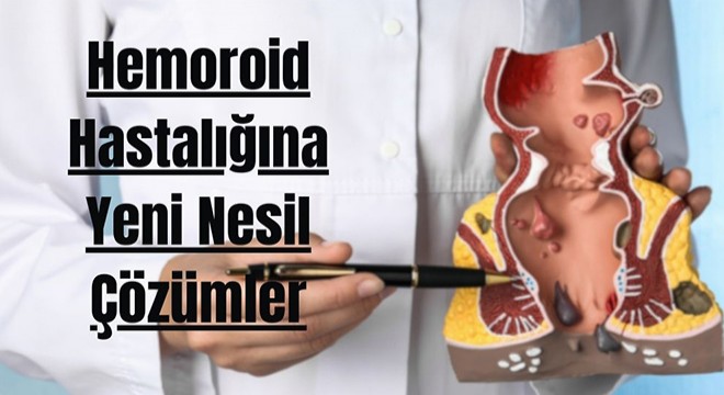 Hemoroid Hastalığına Yeni Nesil Çözümler