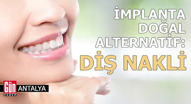 Antalya'da implanta doğal alternatif; diş nakli