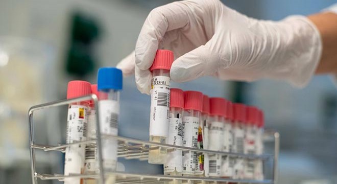 İngiltere’de virüsten ölenlerin sayısı 35’e çıktı