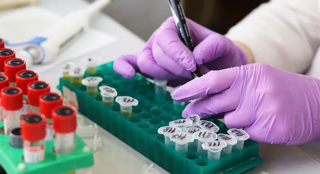 İngiltere'de yeni yüzde 100 doğruluk payı olan koronavirüs testi