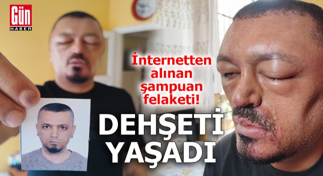 İnternetten alınan şampuan felaketi!