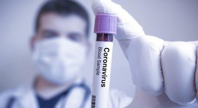 İran'da koronavirüsten 97 kişi daha hayatını kaybetti
