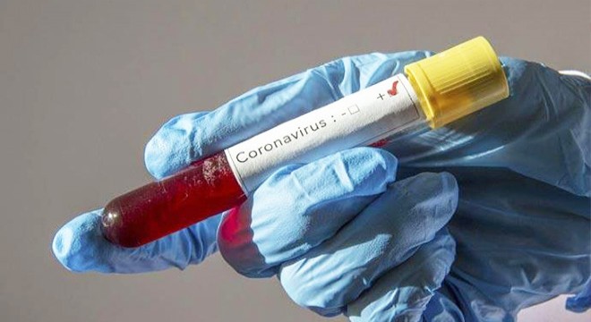 İran'da koronavirüsten ölenlerin sayısı 1284’e çıktı