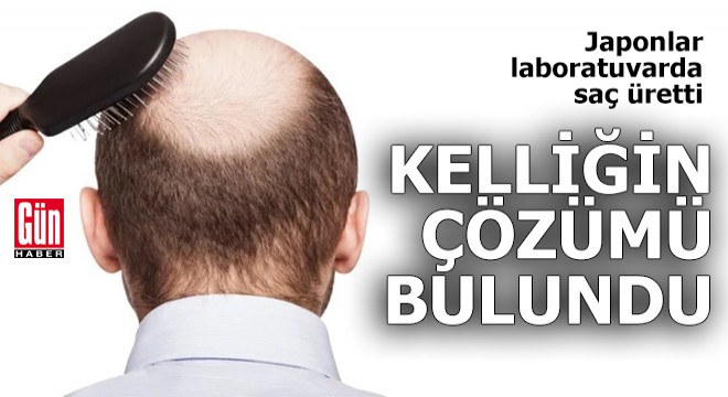 Kelliğin çözümü bulundu: Japonlar laboratuvarda saç üretti