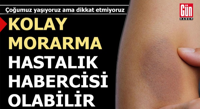Kolay morarmalar hastalık habercisi olabilir