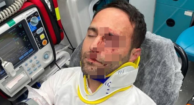 Komşusu imamı dövüp, telle boğmaya kalkıştı