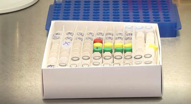 Koronavirüs için geliştirilen yerli kitin laboratuvar görüntüleri paylaşıldı