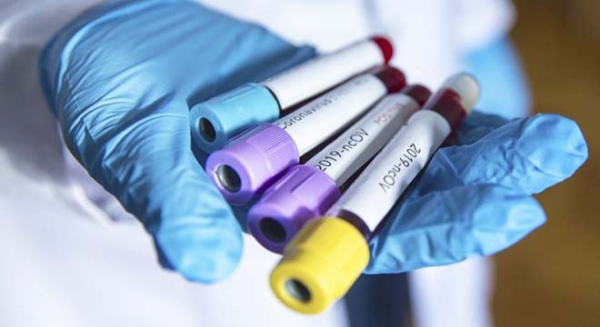 Koronavirüs salgınında ölü sayısı 3 bin 825’e yükseldi