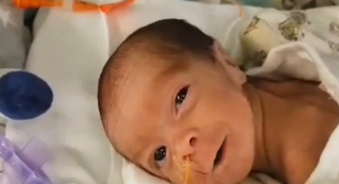 Koronavirüs taşıyan kadın entübe sırasında doğum yaptı