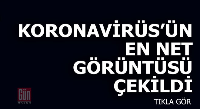 Koronavirüs'ün en net görüntüsü çekildi