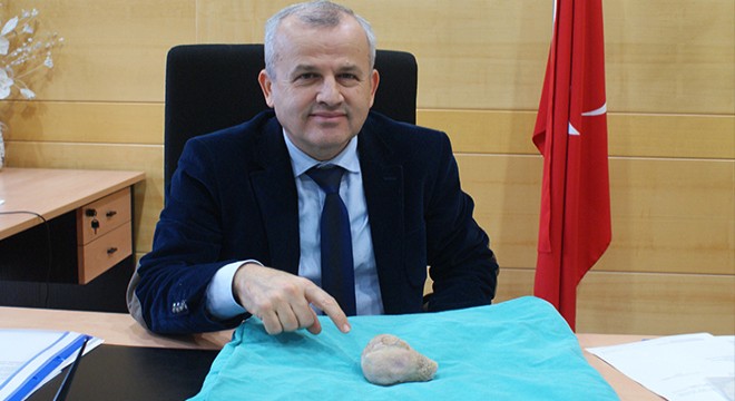 Mesanesinden 270 gram taş çıkarıldı