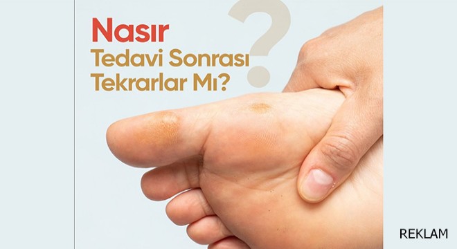 Nasır Tedavi Sonrası Tekrarlar Mı?