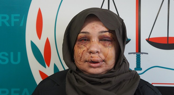 Polis eşi tarafından darbedildiği iddiasıyla şikayetçi oldu