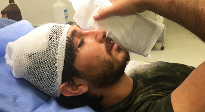 Rapor almaya gelen baba- oğul, doktoru dövdü