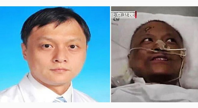 Rengi değişen Çinli doktor Covid-19'dan öldü