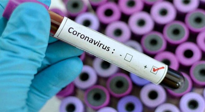 Rusya'da son 24 saatte 9 bin 974 yeni koronavirüs vakası