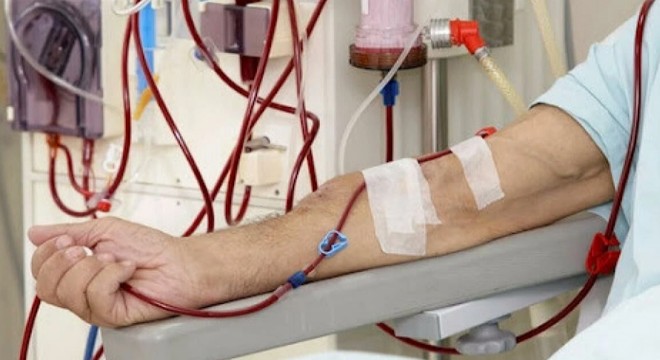 Sağlık Bakanlığı: 70 bini aşkın hasta diyaliz tedavisi görüyor