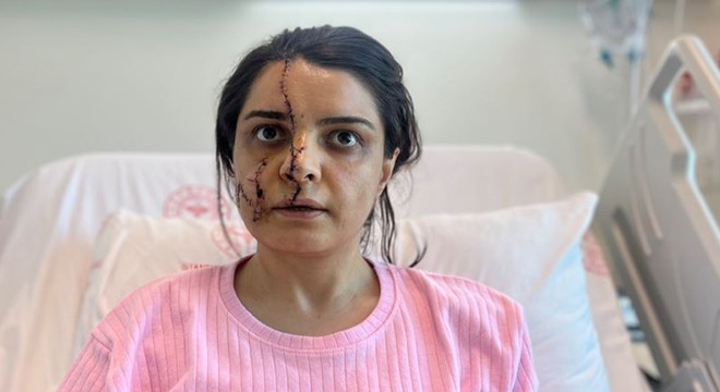 Saldırıya uğrayan kadın yüzündeki 40 dikişle dehşet dolu anları anlattı
