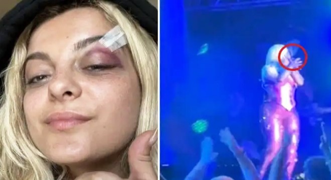 Şarkıcı Bebe Rexha'ya sahnede telefonla saldırdılar