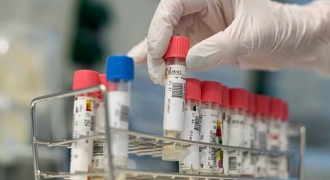 Semptom göstermeyen hastaları da tespit eden test geliştirildi