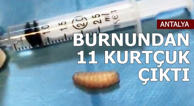 Sinüslerinden 11 kurtçuk çıktı