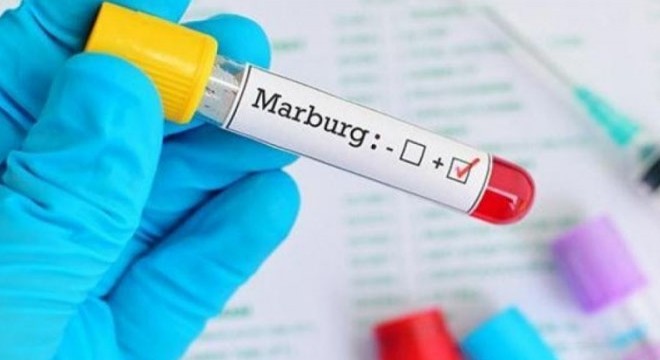 Tanzanya'da Marburg virüsü nedeniyle 8 kişi hayatını kaybetti