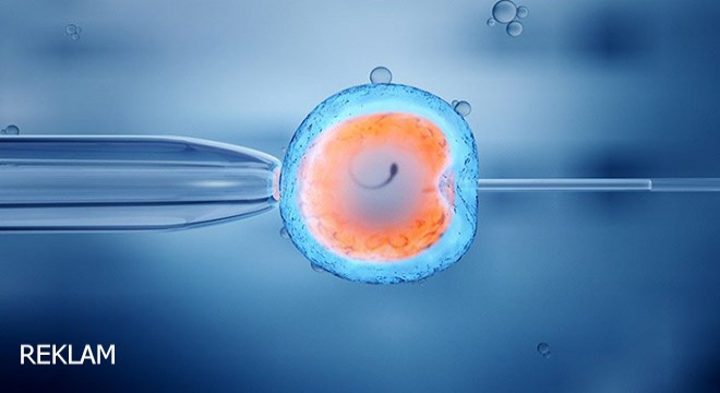 Tüp Bebek Tedavisi Aşamaları Nelerdir?