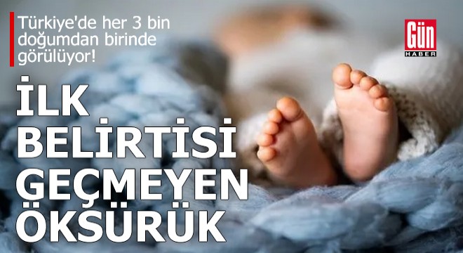 Türkiye'de her 3 bin doğumdan birinde görülüyor!
