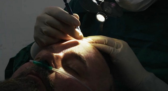 Türkiye'nin En Güvenilir 5 Saç Ekim Merkezi (2026 Güncel Rehber)