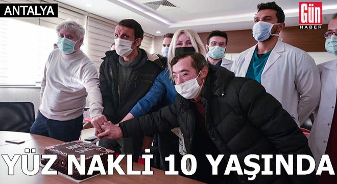 Türkiye'nin ilk yüz naklinin üzerinden 10 yıl geçti