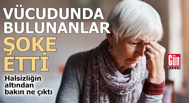 Vücudunda bulunanlar şoke etti! Halsizliğin altından bakın ne çıktı