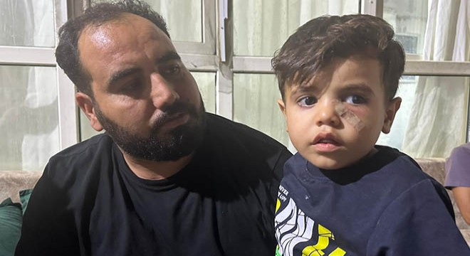 Yorgun mermi, 4 yaşındaki çocuğun gözünün altına isabet etti