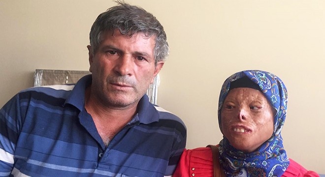 Yüz nakli bekleyen Leyla, Ömer Özkan'la görüşmek için Antalya'da