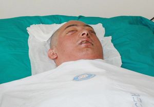 İkinci yüz naklinden ilk fotoğraf